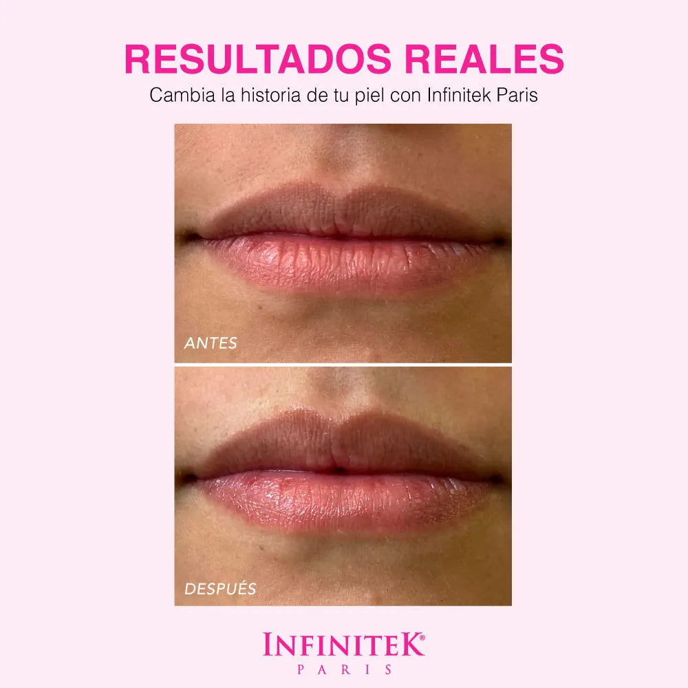 Sugar Kiss
