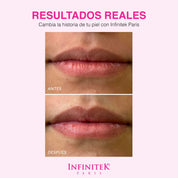 Sugar Kiss