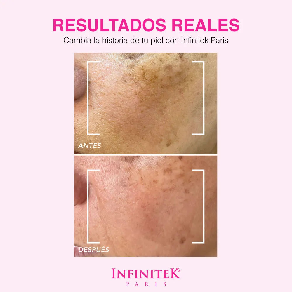 Sérum Clarificante Crystal Rose Con AHA+BHA