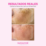 Sérum Clarificante Crystal Rose Con AHA+BHA